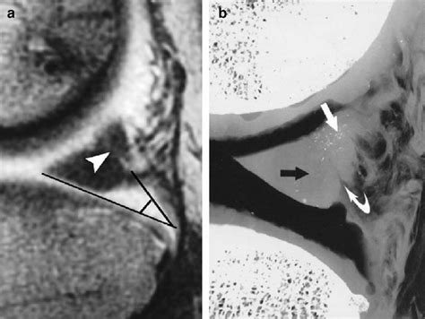 A Sagittal T1 Weighted Spin Echo MR Image 600 Ms 20 Ms Of A