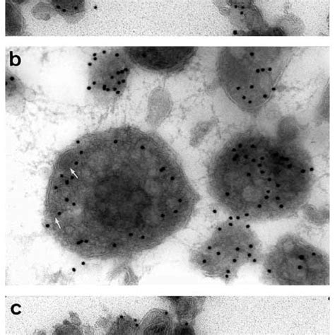 Cryo Immuno Electron Microscopy Of Endosomal Fractions With