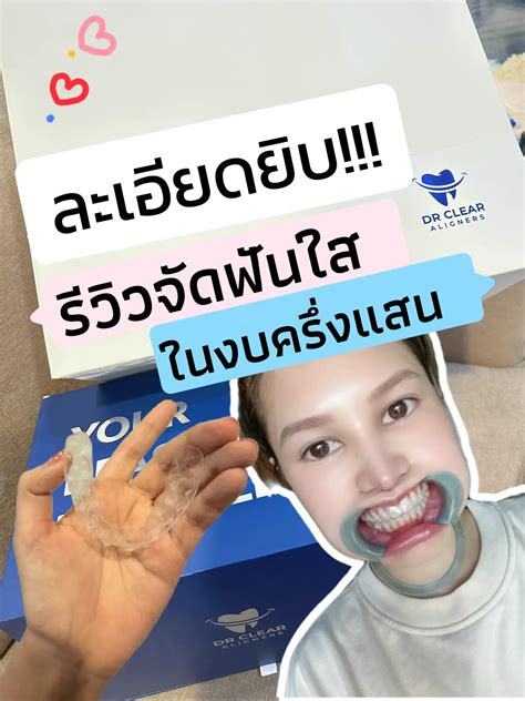 รีวิวจัดฟันใส🦷 ในงบครึ่งแสน ละเอียดยิบ แกลเลอรีที่โพสต์โดย Ferrnoi