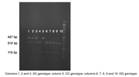 Scielo Brasil Association Between Col1a2 Polymorphism And The Occurrence Of Pelvic Organ