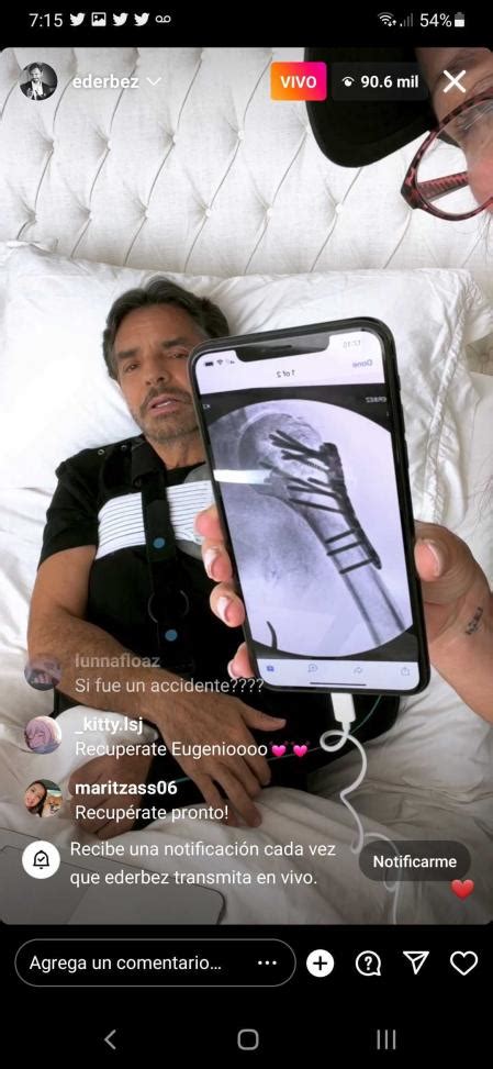 Eugenio Derbez Reaparece Y Explica Con Detalles Su Accidente Lloro