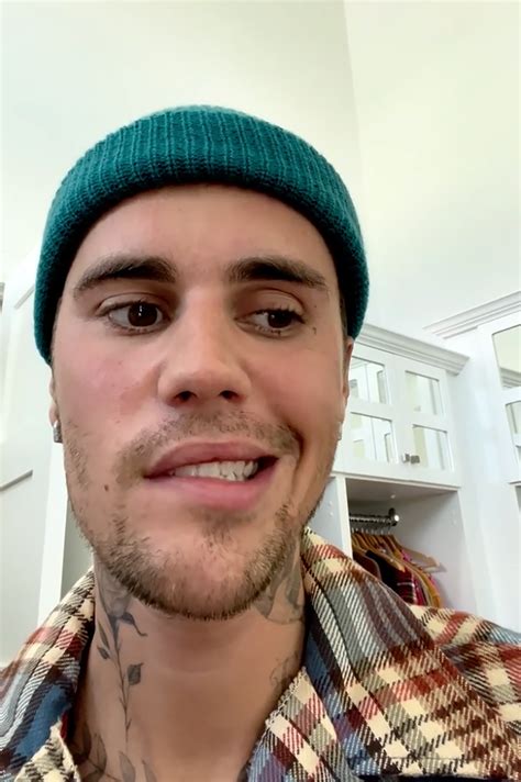 Justin Biebers Face Paralyzed After Rare Disorder Diagnosis