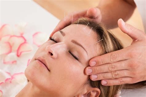 Acupuncture For Migraines How It Works Osteopathic Center For Healing