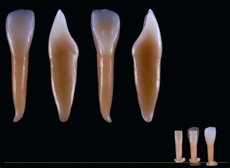 4 DENTAL MORPHOLOGY | Pocket Dentistry