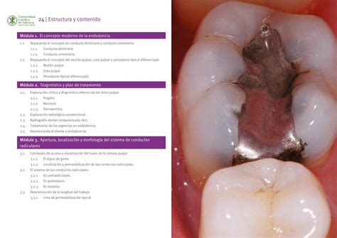 PDF Máster Online en Endodoncia y Microcirugía Apical Este Máster