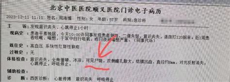 周海媚病歷外洩 曝急救前冒屍斑 北京衛健委喊查 中港最吸睛 娛樂 世界新聞網