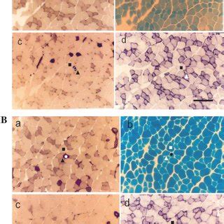 Extensor Digitorum Longus Edl Muscle From Heterozygous A And