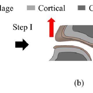 Determination Of Cartilage Thickness By Structural Analysis A In