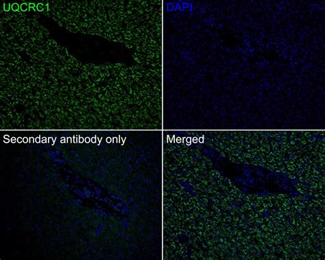 Ubiquinol Cytochrome C Reductase Core Protein I Recombinant Rabbit Mon