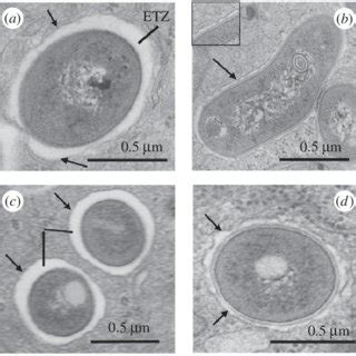 Ultrastructural Differences Of The M Abscessus S Or R Containing