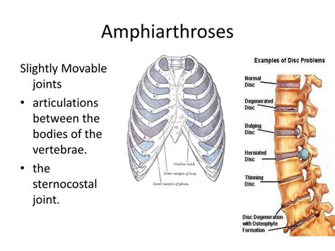 PPT - Joints or Articulations PowerPoint Presentation, free download - ID:2038133