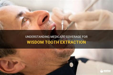 Understanding Medicare Coverage For Wisdom Tooth Extraction MedShun