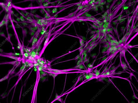 Neural Stem Cell Culture Stock Image C Science Photo Library