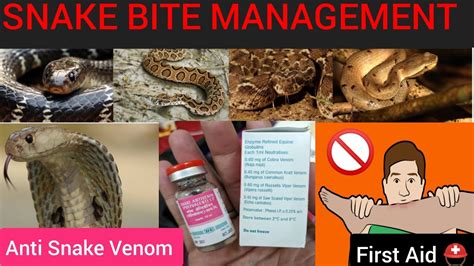 Snake Bite Management First Aid In Snake Bite Antisnakevenom YouTube