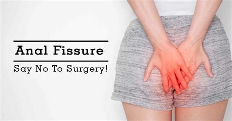 How To Cure Fissure Permanently How To Heal Anal Fissure Anal At Home