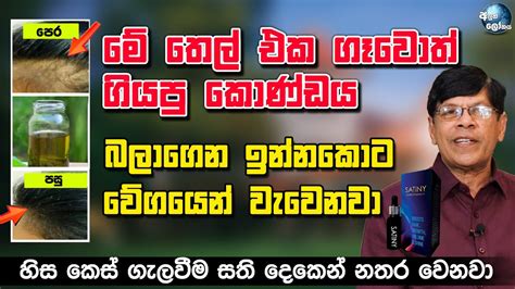 මේ තෙල් එක ගෑවොත් කොණ්ඩය බලාගෙන ඉන්නකොට වේගයෙන් වැවෙනවා Herbal Haircare Growing Oil Youtube