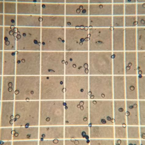 Python Counting Yeast Cells From A Hemocytometer Image Using OpenCV