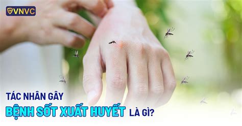 Cách phòng và điều trị bệnh án sốt xuất huyết trẻ em hiệu quả và an toàn