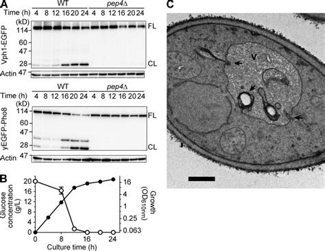 Vacuolar Dynamics After Diauxic Shift A Immunoblot Analyses Of