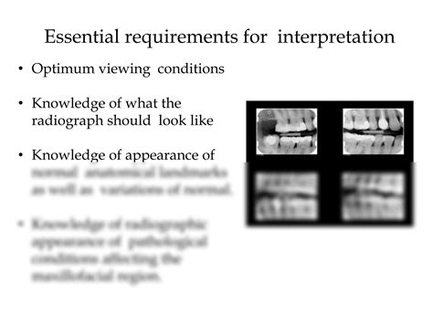 Solution Leture Radiology Principles Of Radiographic Interpretation