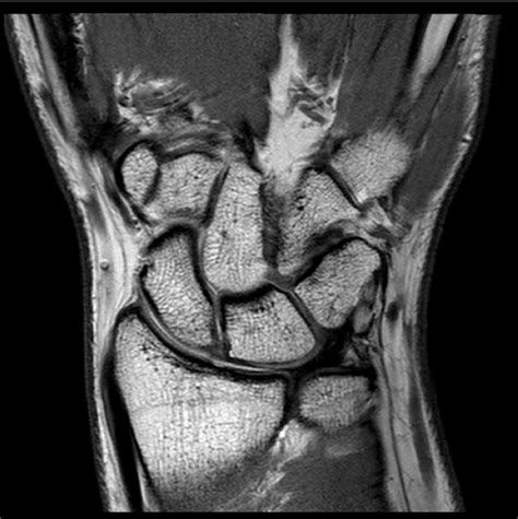 Mri Diagram Quizlet