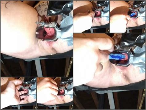 Medical Fetish Sex The Stretched Sub Stretched Sub Peehole Stretching