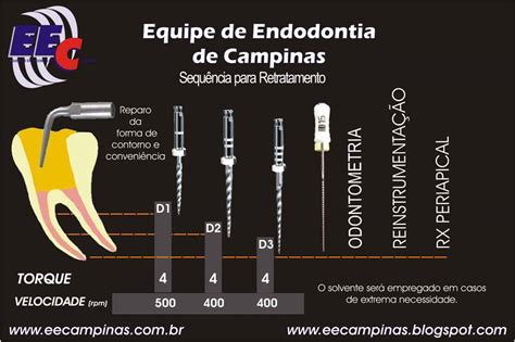 Equipe De Endodontia De Campinas Protocolo Para Retratamento