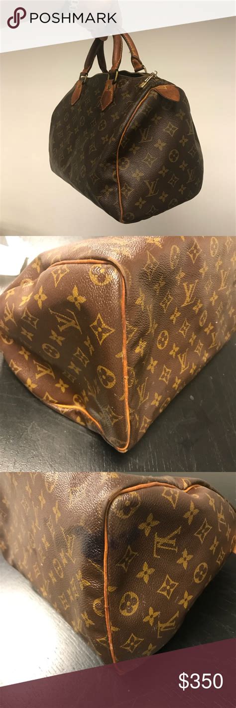 Louis Vuitton Zipper Pull Tab Replacement Parts Literacy Basics