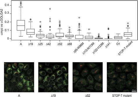 Subcellular localization of stably transfected A transferase mutants ... 