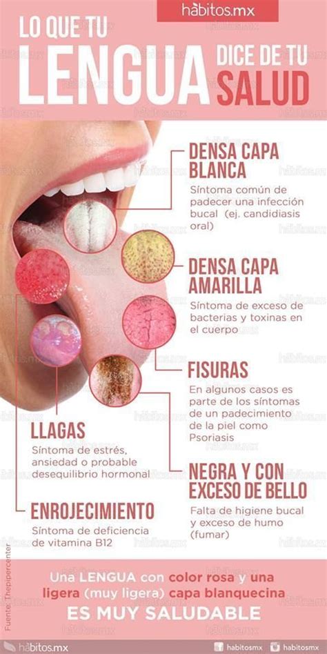 Lo Que Tu Lengua Dice De Tu Salud H Bitos Health Coachi