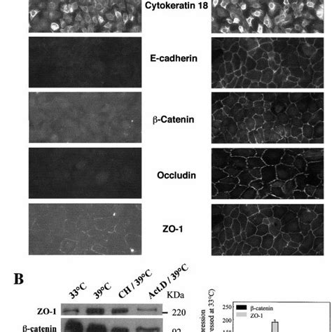 A Expression Of Cytokeratin 18 E Cadherin Catenin Occludin And