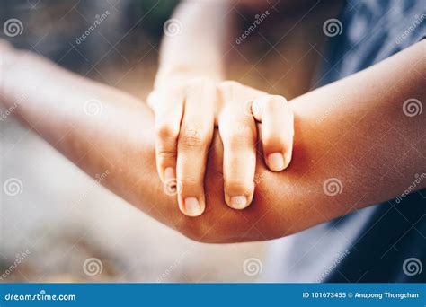 Elbow Bone Fracture Stock Photo 101673564