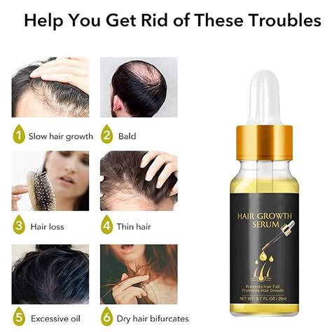 Biotin Thickening Herbal Serum Fast Hair Growth Serum Oil Ginger Hair