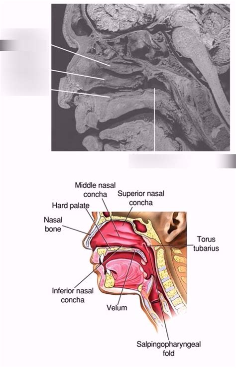 Nasal Cavities Part Diagram Quizlet