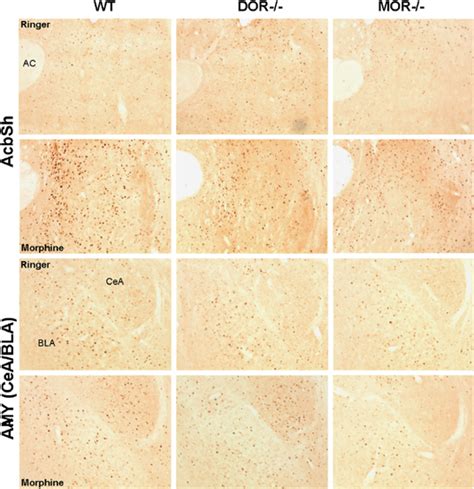 Photomicrographs Of Morphine Icsa Induced Fos Protein Expression Within