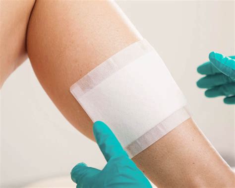 Superabsorbent Dressings For Hard To Heal Exuding Wounds Absorbest