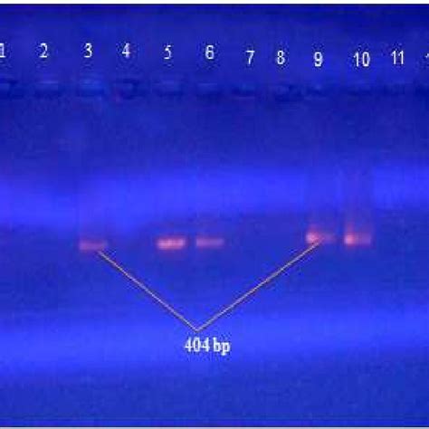 Gel Electrophoresis Lane Of Download Scientific Diagram