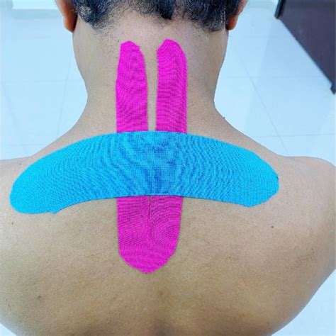 Pdf The Effect Of Kinesio Taping On Cervical Proprioception In