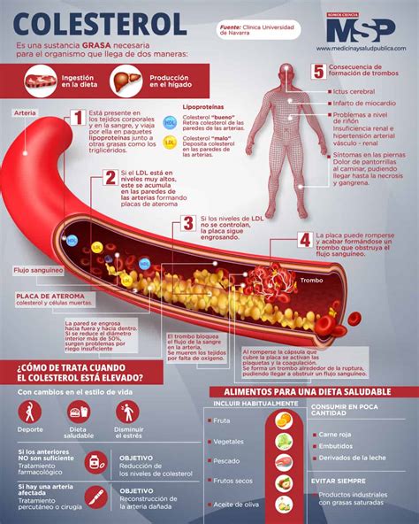 Colesterol Infograf A