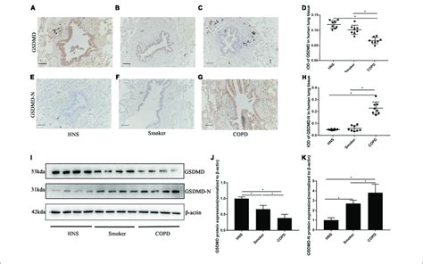 GSDMD N Expression Was Upregulated In AECs From Patients With COPD