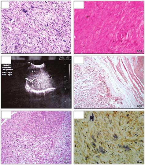 Assessment Of The Biopsy Samples At Various Stages A The First