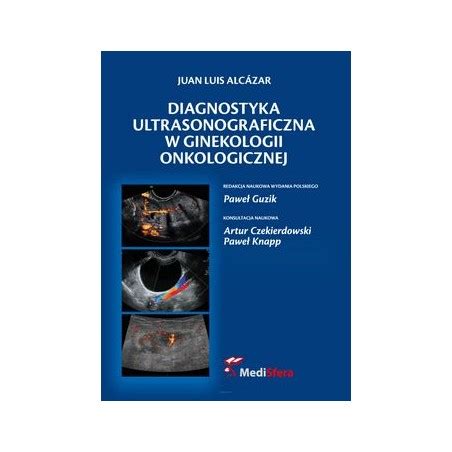 Diagnostyka Ultrasonograficzna W Ginekologii Onkologicznej Alcazar