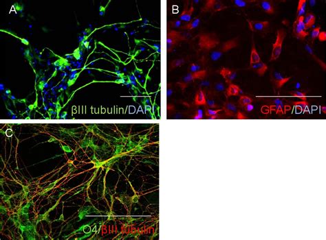 Direct Induction Of Human Neural Stem Cells From Peripheral Blood