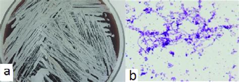 A Small Chalky White Non Haemolytic Colonies Of The Isolate On Blood