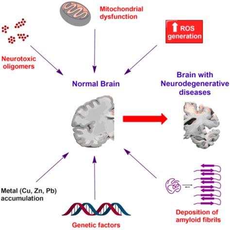 Neurodegenerative Diseases Functional Medical Corporation