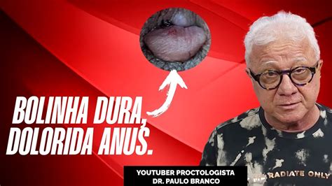 Bolinha Dura Dolorida Anus Que Apareceu Subitamente Qual O Diagn Stico