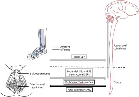 What Is Bulbocavernosus Reflex And How It Is Performed