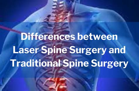 Laser Spine Surgery And Traditional Spine Surgery