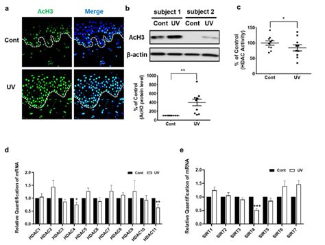 Acetylated Histone H Was Increased But Hdac Activity And Expression