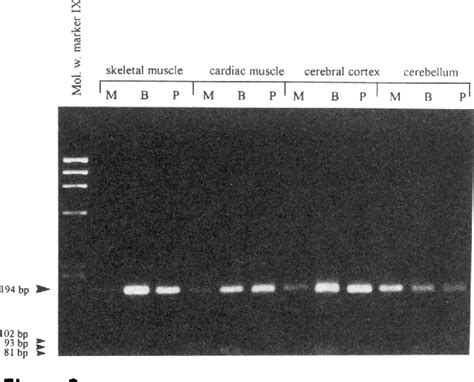 Transcription Of The Dystrophin Gene In Normal Tissues And In Skeletal